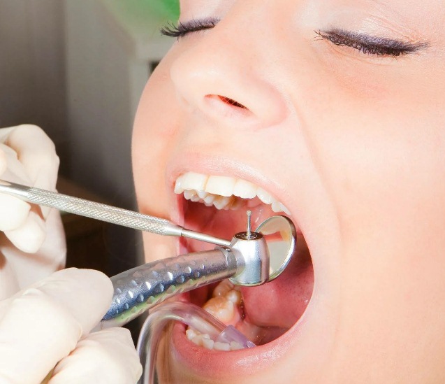 Лечение периодонтита зубов4