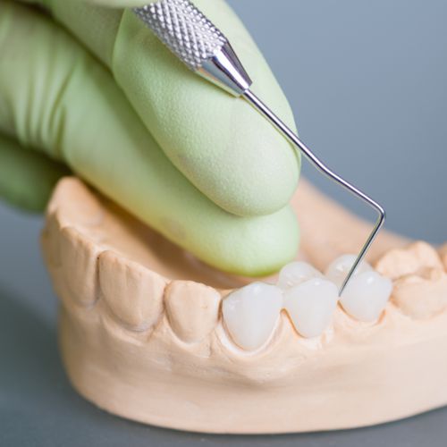 Протезирование зубов в СПБ5