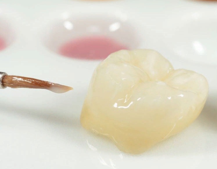 Протезирование зубов коронками2